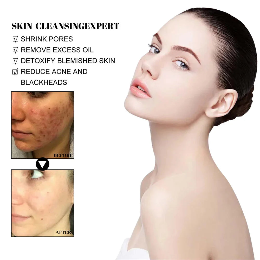 West & Month Remove Cravos, Lama Sólida, Máscara Facial Refrescante, Limpeza da Pele, Hidratante, Controle de Oleosidade, Diminuição dos Poros, Cuidados com a Pele