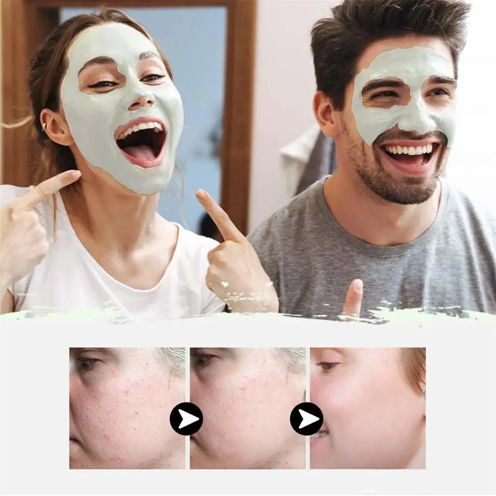 West & Month Remove Cravos, Lama Sólida, Máscara Facial Refrescante, Limpeza da Pele, Hidratante, Controle de Oleosidade, Diminuição dos Poros, Cuidados com a Pele